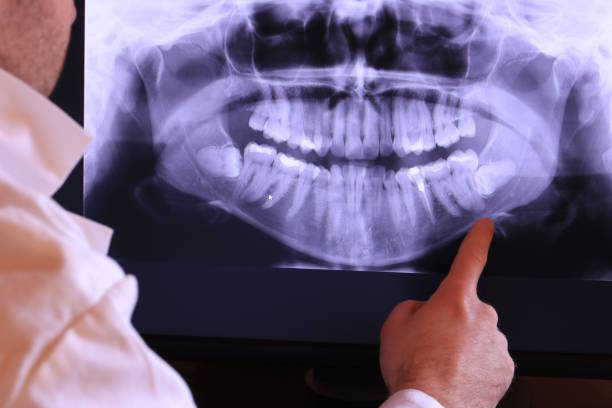 Best Urgent Tooth Repair  in Samson, AL