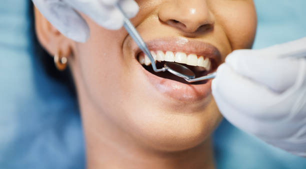 Best Cracked Tooth Emergency Dentist  in Samson, AL